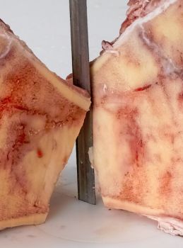 ITB Exakt AMP Medical