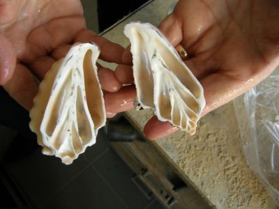 ITB Exakt AMP Medical