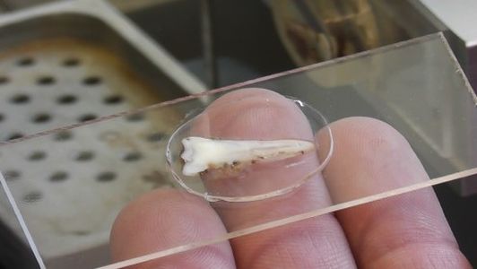 ITB Exakt AMP Medical